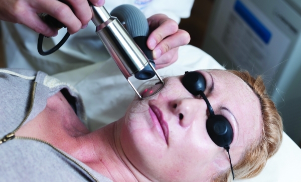 AESTHETIC MEDECINE Reportage in the Mozart Clinic in Nice, France. Fractional CO2 laser session. During treatment, the surgeon applies cold air to calm the heat effect of the laser. ALBANE NOOR / BSIP