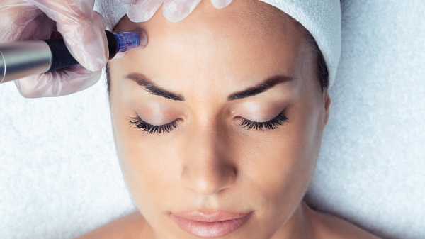gafencu beauty treatment facial Skin Deep Non-invasive instead of Botox