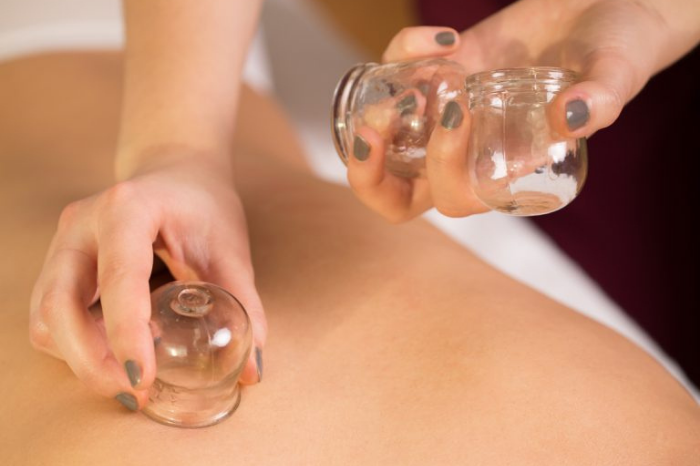 traditional chinese medicine tcm cupping therapy what is it and where to go gafencu hong kong (4)