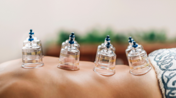 Cupping Therapy: The different types, which to go for and where?